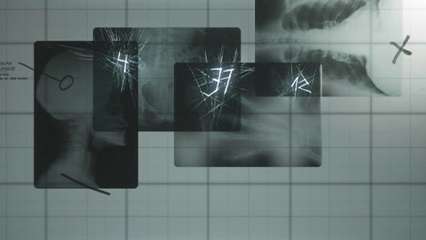 راهنمای قدم به قدم Silent Hill 2 قسمت ششم: Brookhaven Hospital